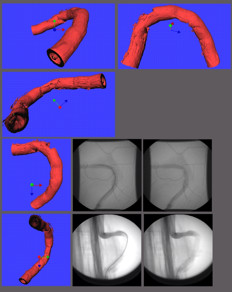 3D Bovine Artery Reconstruction (IVUS + Biplan Angio)